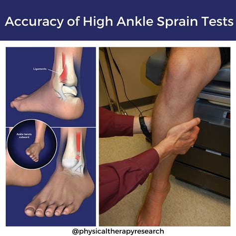 test for interosse membrane tear|High Ankle Sprain .